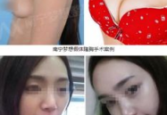 南宁整形,美丽蜕变，专业护航