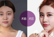 临沂整形,专业机构汇聚，美丽蜕变之旅